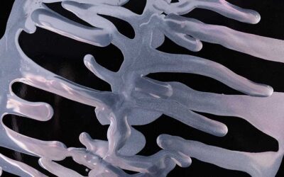 Connected Issues: Understanding Ehlers-Danlos Syndrome and Endometriosis